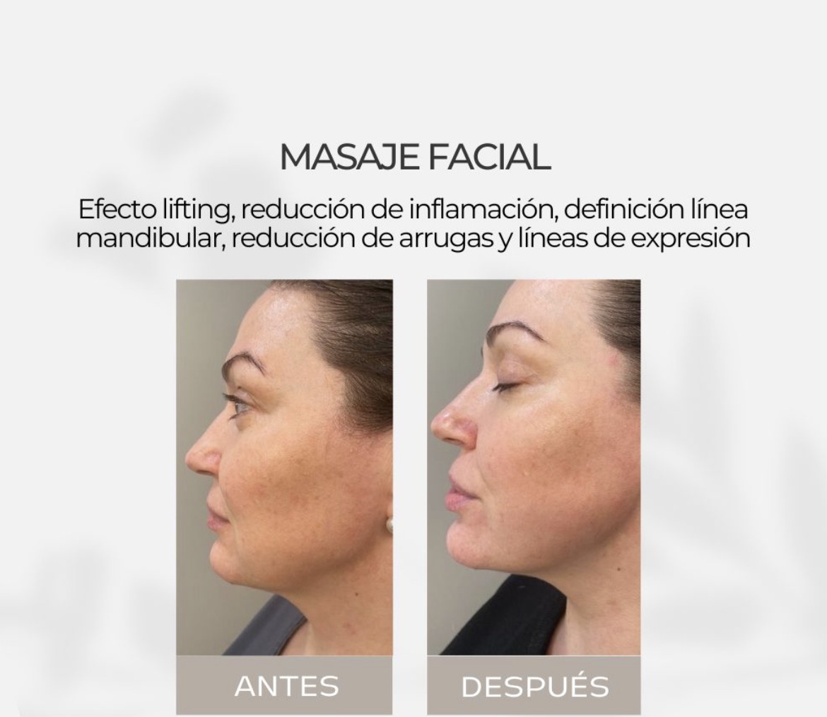 Antes y después - Masaje Facial