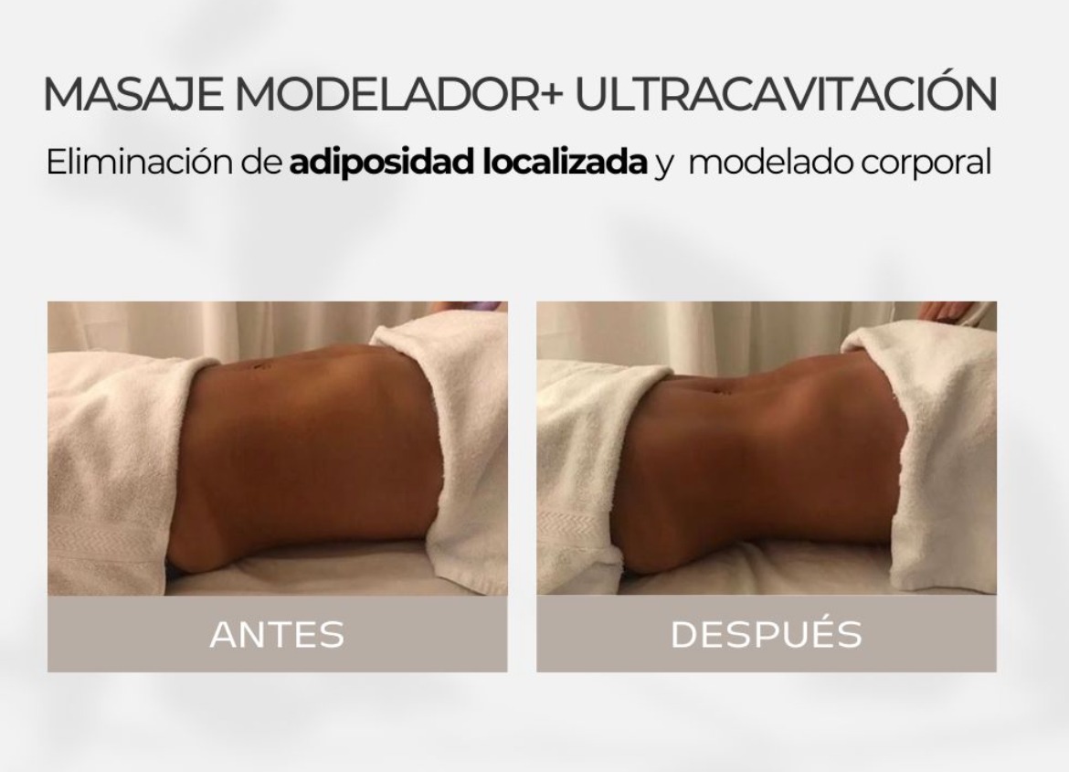 Antes y después - Masaje Modelador Corporal