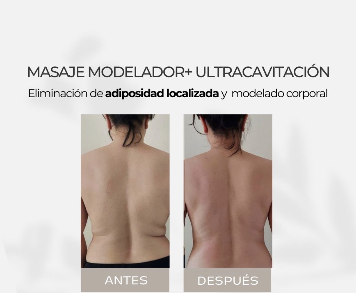Antes y después - Masaje Modelador Espalda